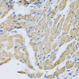 Immunohistochemistry - Anti-CRHBP Antibody (A15279) - Antibodies.com