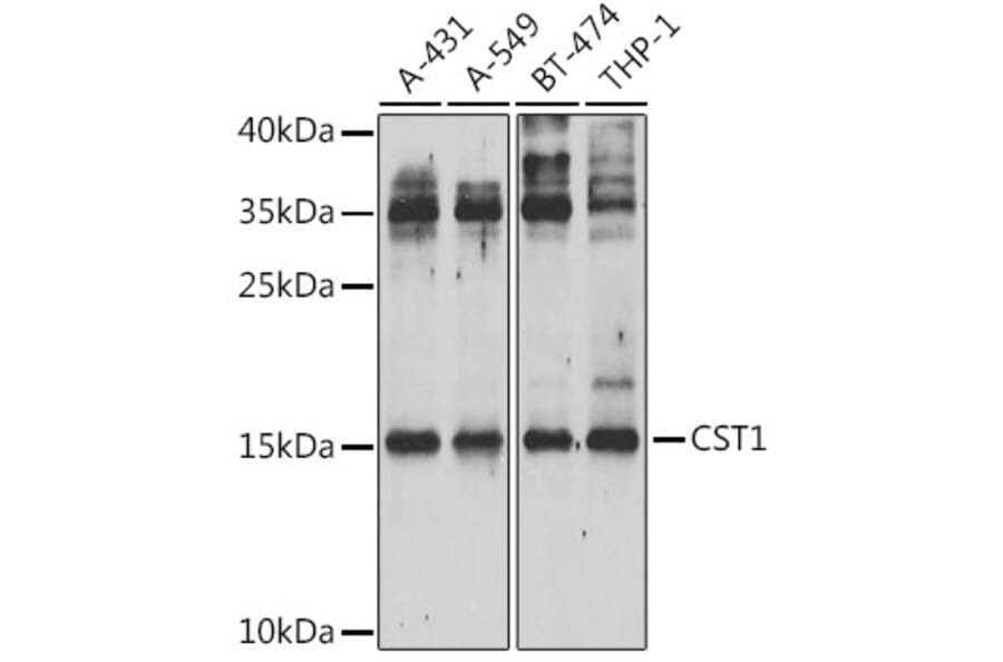 Western Blot - Anti-Cystatin SN/CST1 Antibody (A15280) - Antibodies.com