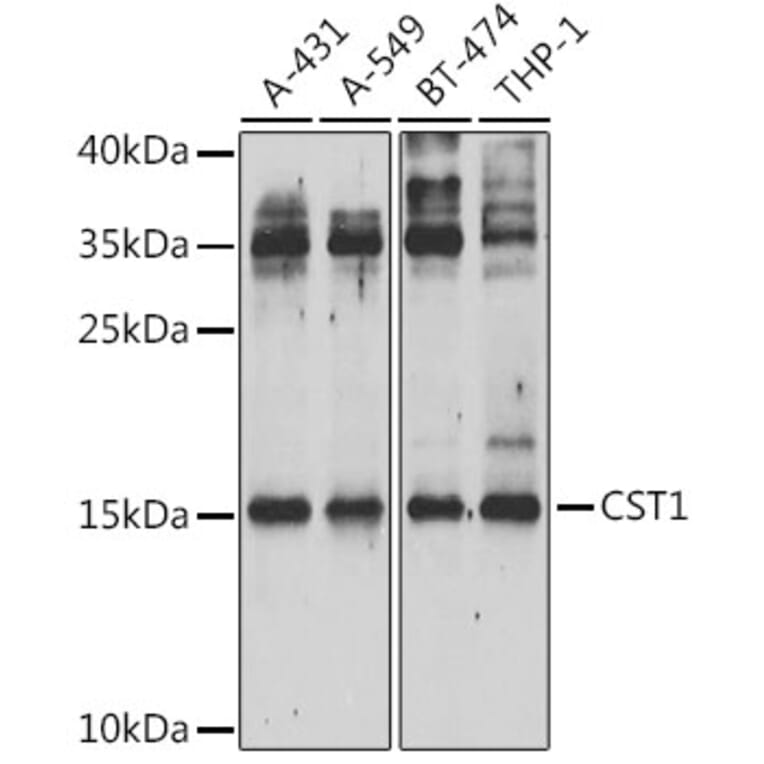 Western Blot - Anti-Cystatin SN/CST1 Antibody (A15280) - Antibodies.com