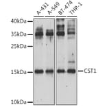Western Blot - Anti-Cystatin SN/CST1 Antibody (A15280) - Antibodies.com