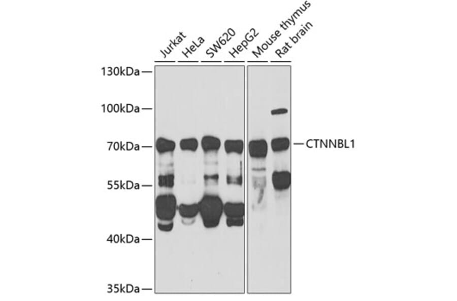 Western Blot - Anti-CTNNBL1 Antibody (A15281) - Antibodies.com