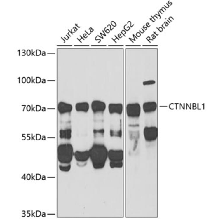 Western Blot - Anti-CTNNBL1 Antibody (A15281) - Antibodies.com