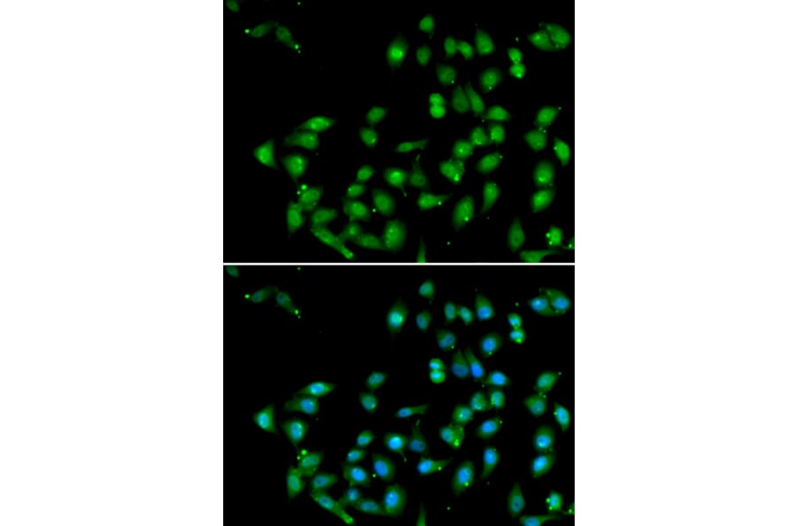 Immunofluorescence - Anti-CTNNBL1 Antibody (A15281) - Antibodies.com