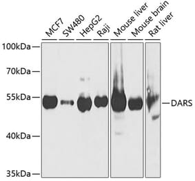 Western Blot - Anti-DARS Antibody (A15282) - Antibodies.com