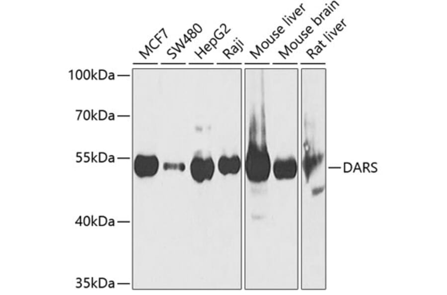 Western Blot - Anti-DARS Antibody (A15282) - Antibodies.com