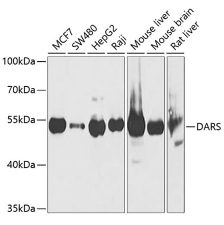 Western Blot - Anti-DARS Antibody (A15282) - Antibodies.com