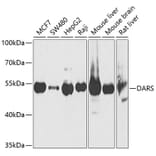 Western Blot - Anti-DARS Antibody (A15282) - Antibodies.com