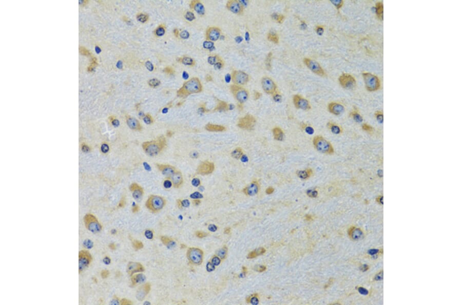 Immunohistochemistry - Anti-DARS Antibody (A15282) - Antibodies.com