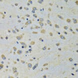 Immunohistochemistry - Anti-DARS Antibody (A15282) - Antibodies.com