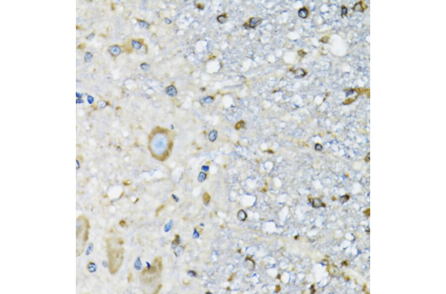 Immunohistochemistry - Anti-DARS Antibody (A15282) - Antibodies.com