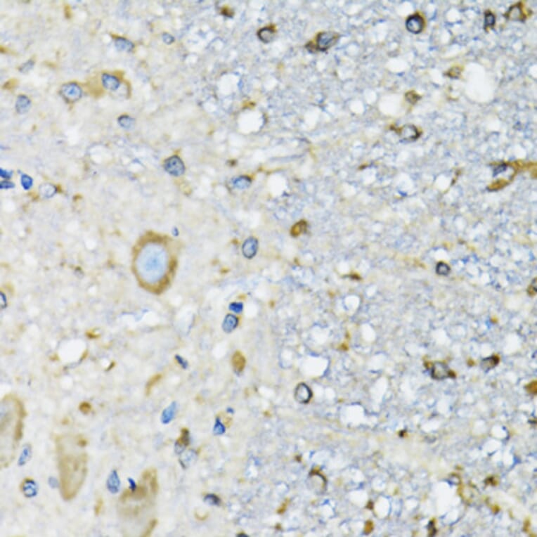 Immunohistochemistry - Anti-DARS Antibody (A15282) - Antibodies.com