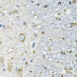 Immunohistochemistry - Anti-DARS Antibody (A15282) - Antibodies.com