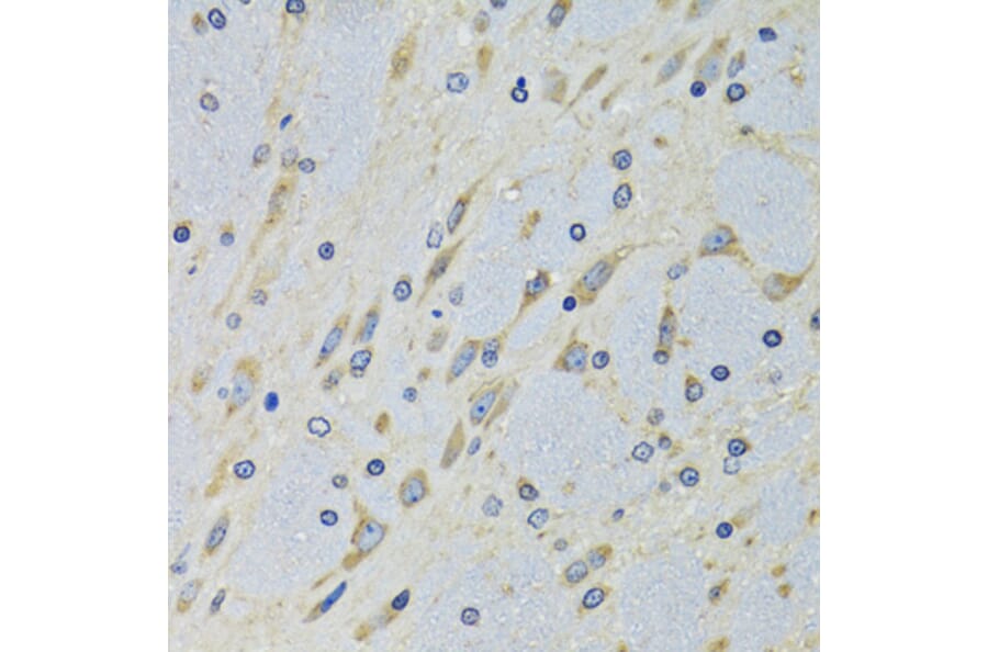 Immunohistochemistry - Anti-DARS Antibody (A15282) - Antibodies.com