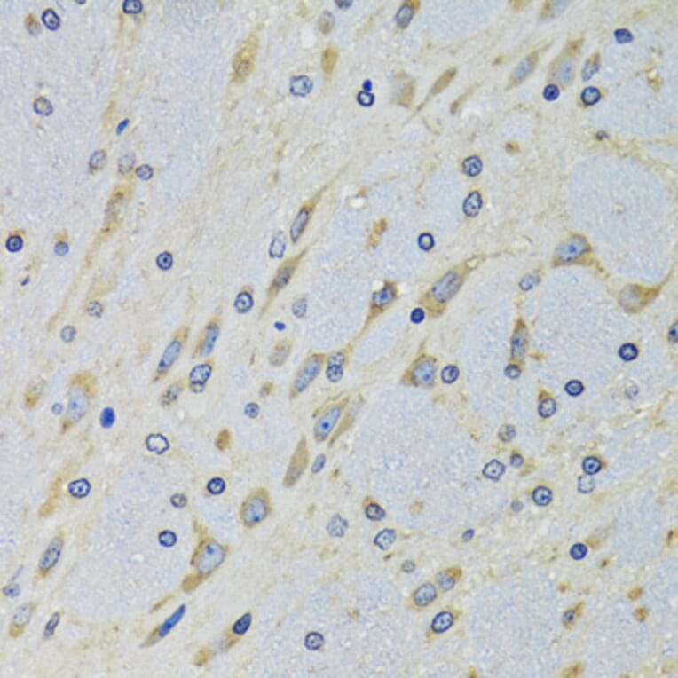 Immunohistochemistry - Anti-DARS Antibody (A15282) - Antibodies.com