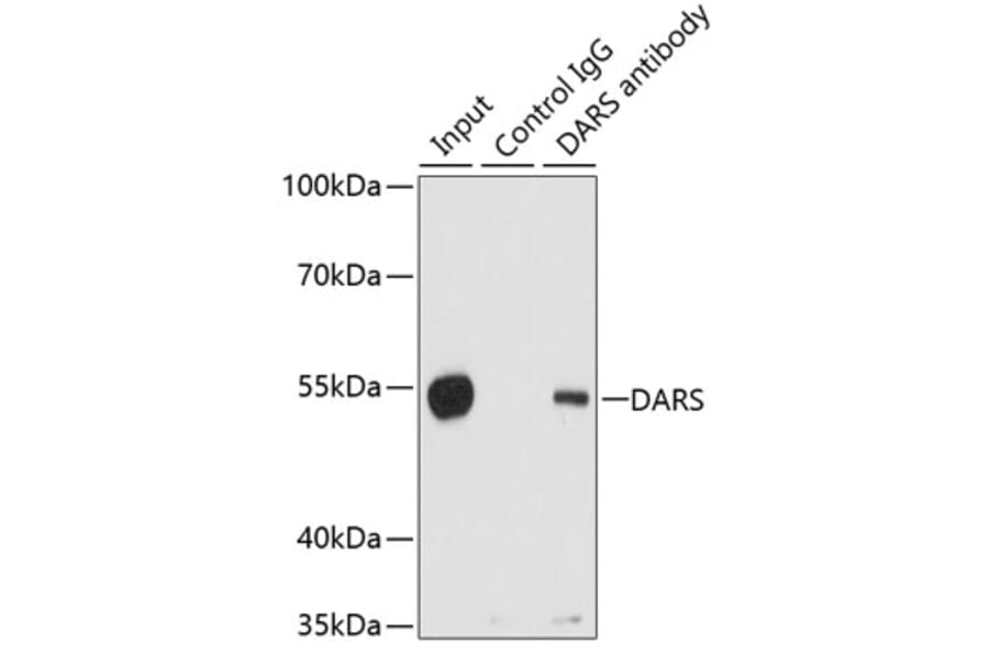 Western Blot - Anti-DARS Antibody (A15282) - Antibodies.com