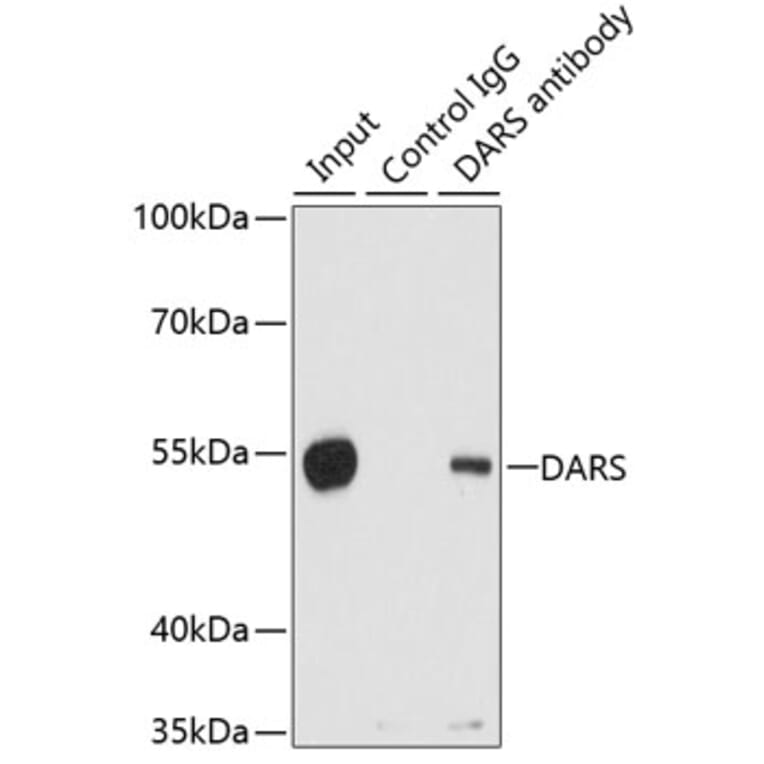 Western Blot - Anti-DARS Antibody (A15282) - Antibodies.com