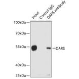 Western Blot - Anti-DARS Antibody (A15282) - Antibodies.com
