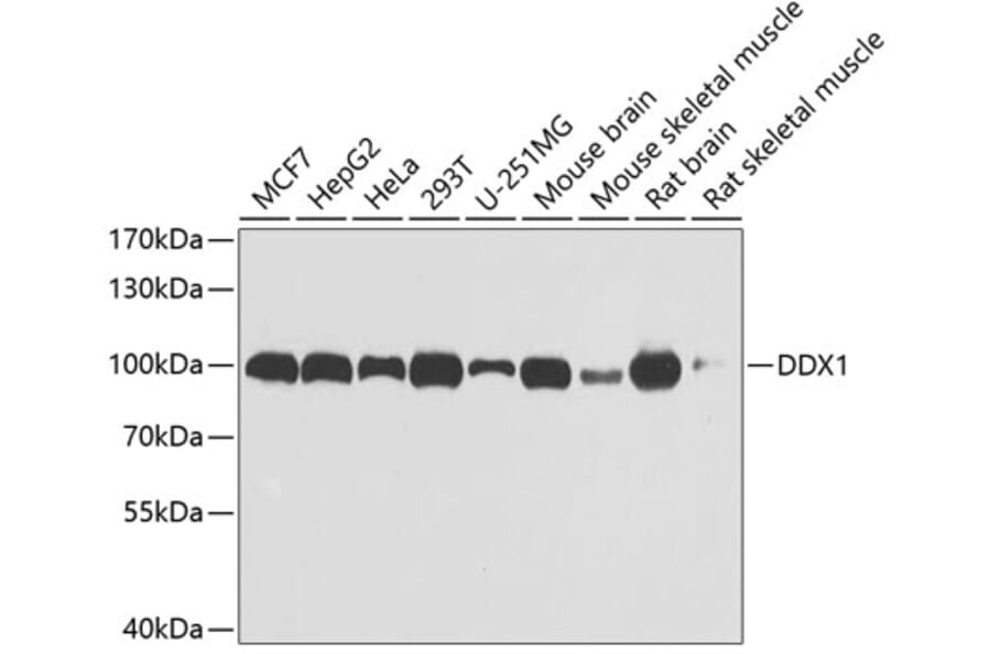 Western Blot - Anti-DDX1 Antibody (A15283) - Antibodies.com
