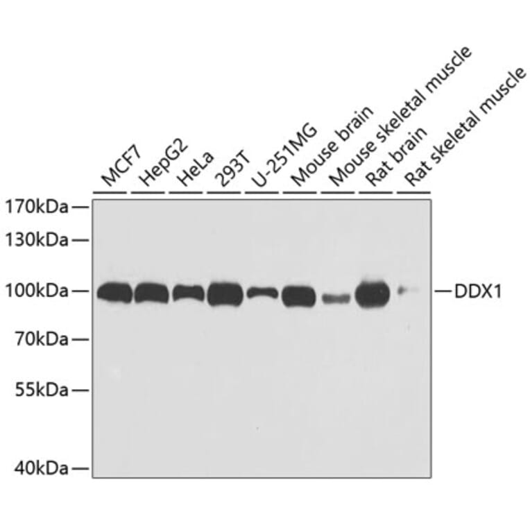 Western Blot - Anti-DDX1 Antibody (A15283) - Antibodies.com