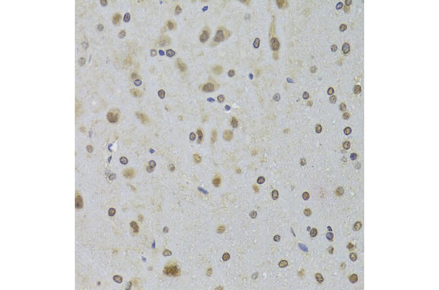Immunohistochemistry - Anti-DDX1 Antibody (A15283) - Antibodies.com
