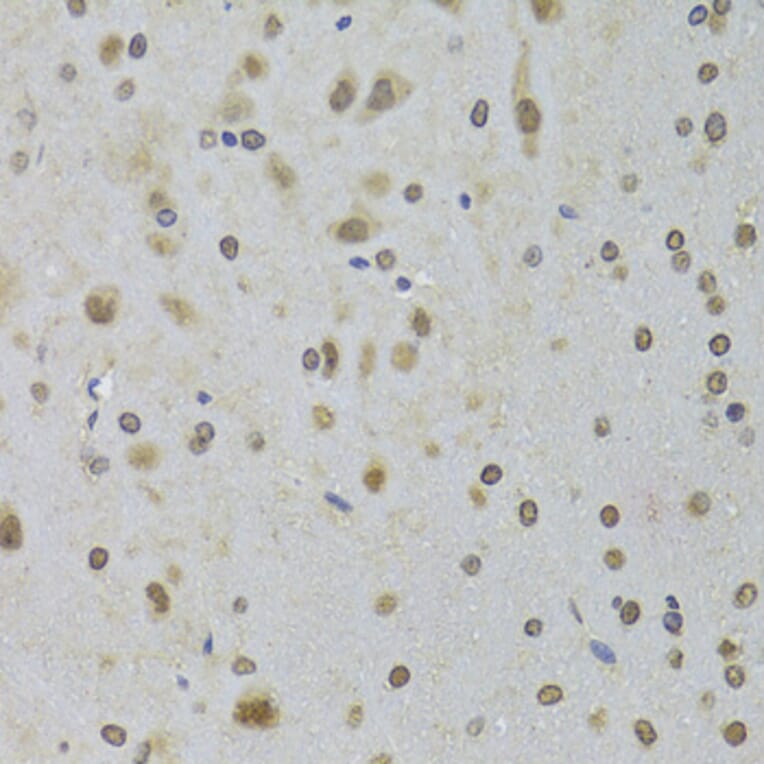 Immunohistochemistry - Anti-DDX1 Antibody (A15283) - Antibodies.com