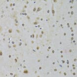 Immunohistochemistry - Anti-DDX1 Antibody (A15283) - Antibodies.com