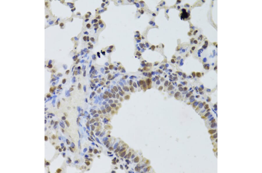 Immunohistochemistry - Anti-DDX1 Antibody (A15283) - Antibodies.com