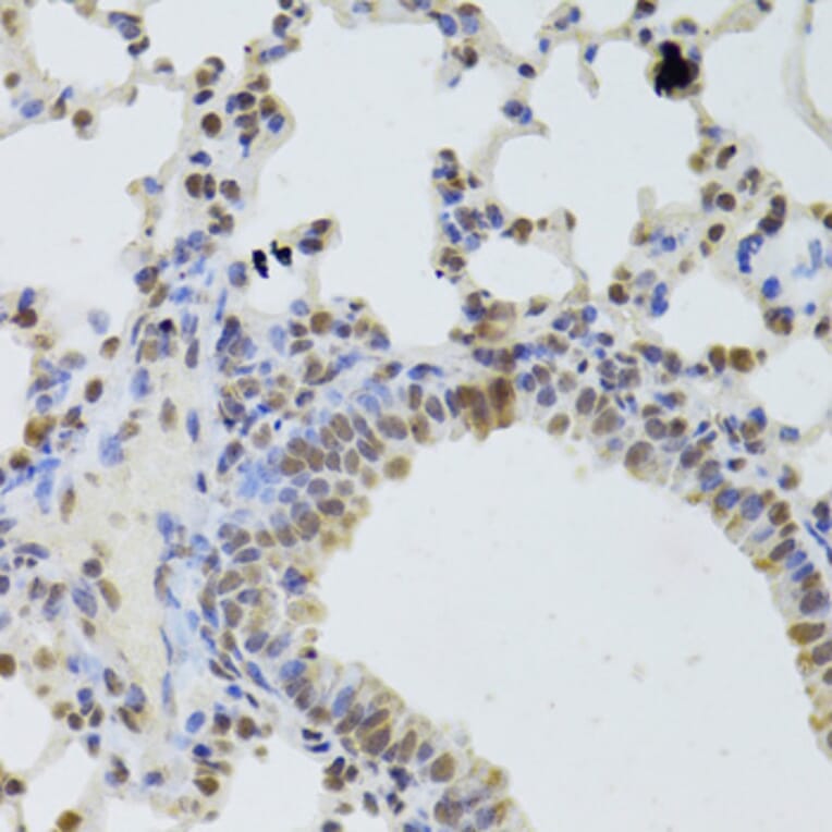 Immunohistochemistry - Anti-DDX1 Antibody (A15283) - Antibodies.com