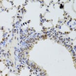Immunohistochemistry - Anti-DDX1 Antibody (A15283) - Antibodies.com