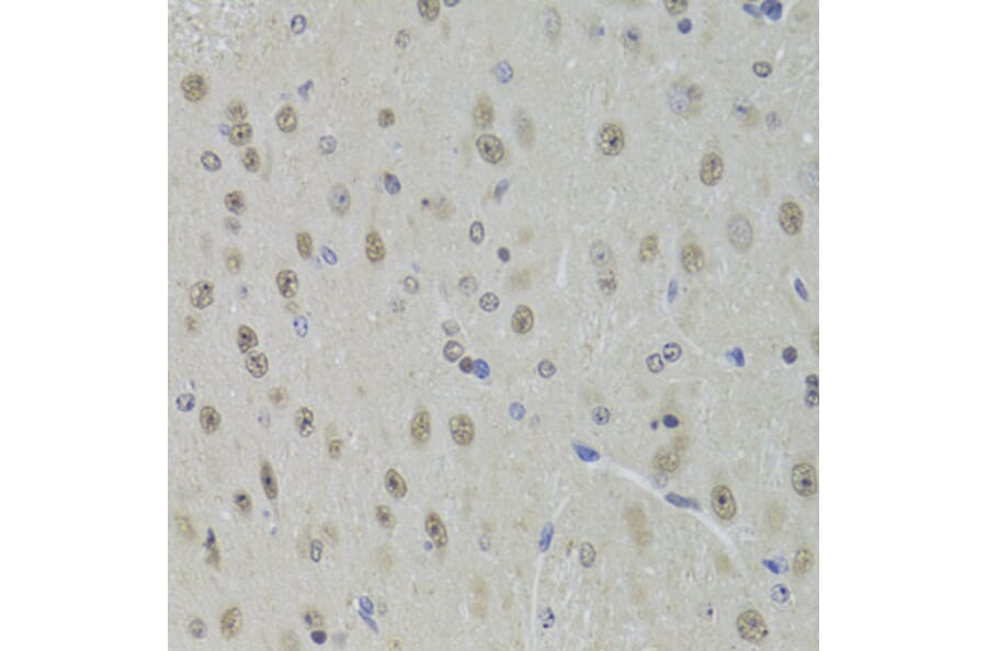 Immunohistochemistry - Anti-DDX1 Antibody (A15283) - Antibodies.com