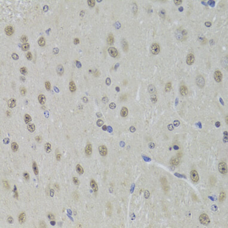 Immunohistochemistry - Anti-DDX1 Antibody (A15283) - Antibodies.com