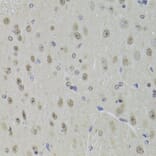 Immunohistochemistry - Anti-DDX1 Antibody (A15283) - Antibodies.com