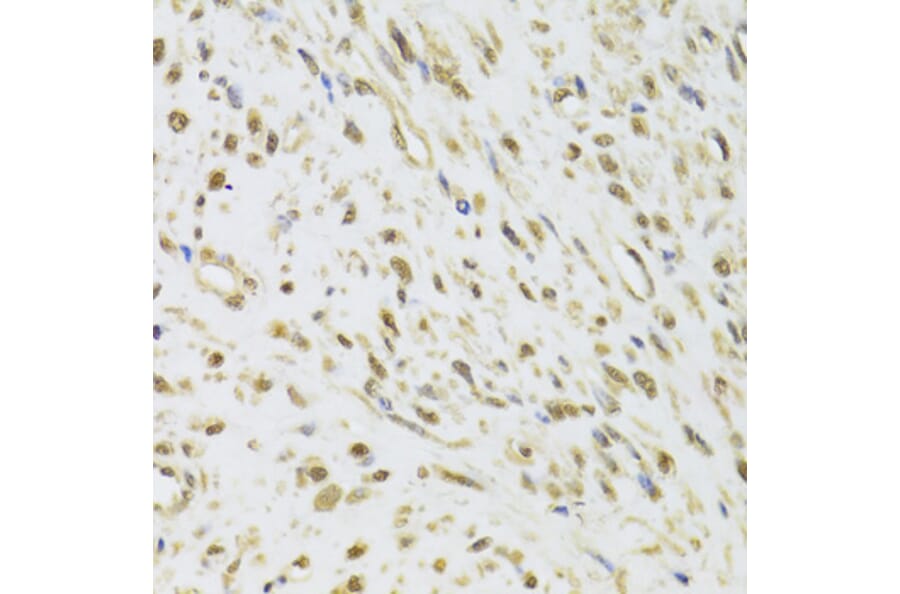 Immunohistochemistry - Anti-DDX1 Antibody (A15283) - Antibodies.com