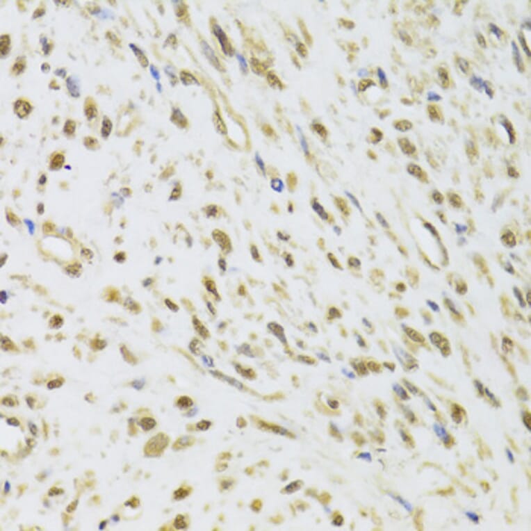Immunohistochemistry - Anti-DDX1 Antibody (A15283) - Antibodies.com