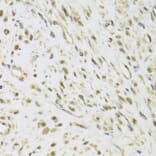 Immunohistochemistry - Anti-DDX1 Antibody (A15283) - Antibodies.com