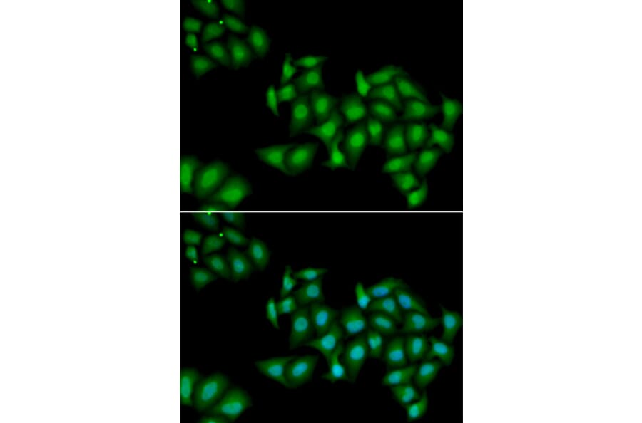 Immunofluorescence - Anti-DDX1 Antibody (A15283) - Antibodies.com