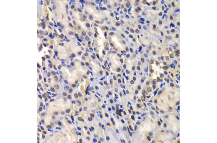 Immunohistochemistry - Anti-DDX41 Antibody (A15284) - Antibodies.com