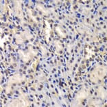 Immunohistochemistry - Anti-DDX41 Antibody (A15284) - Antibodies.com