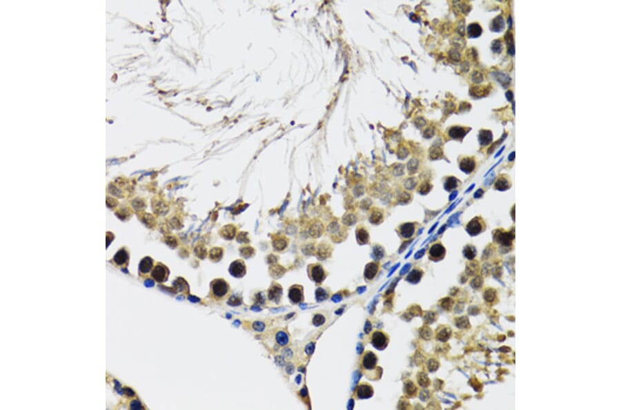 Immunohistochemistry - Anti-DDX41 Antibody (A15284) - Antibodies.com