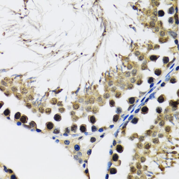 Immunohistochemistry - Anti-DDX41 Antibody (A15284) - Antibodies.com