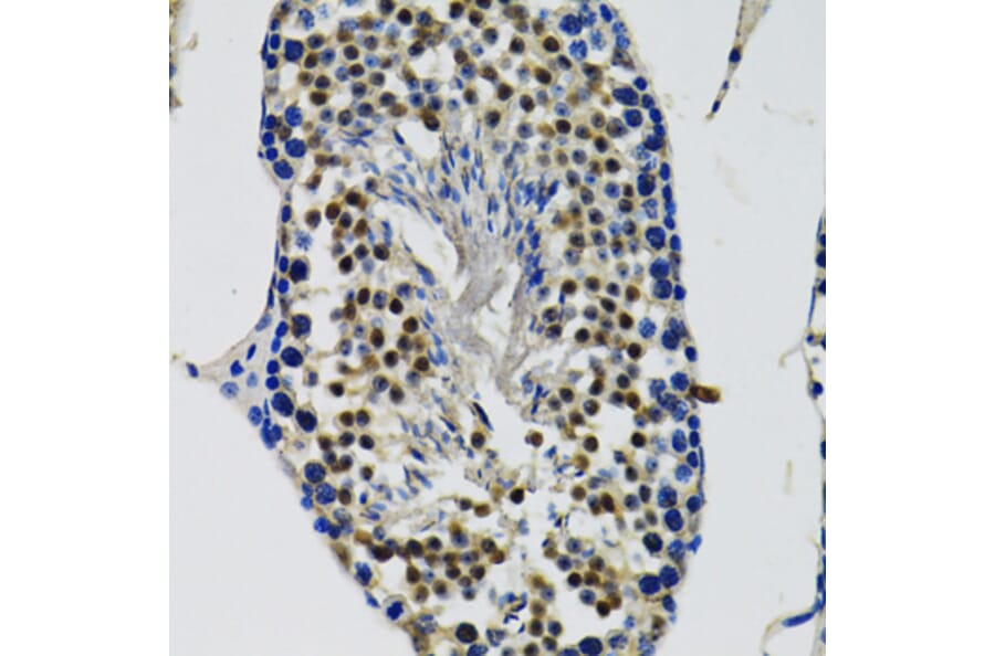 Immunohistochemistry - Anti-DDX41 Antibody (A15284) - Antibodies.com