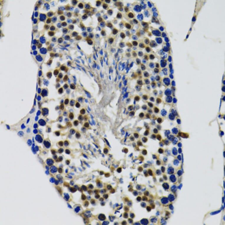 Immunohistochemistry - Anti-DDX41 Antibody (A15284) - Antibodies.com