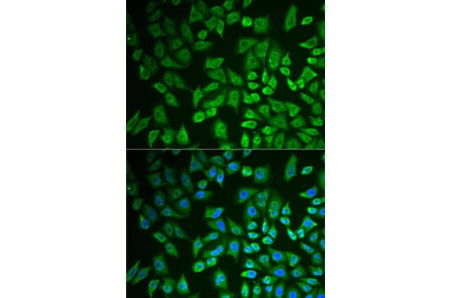 Immunofluorescence - Anti-DDX41 Antibody (A15284) - Antibodies.com