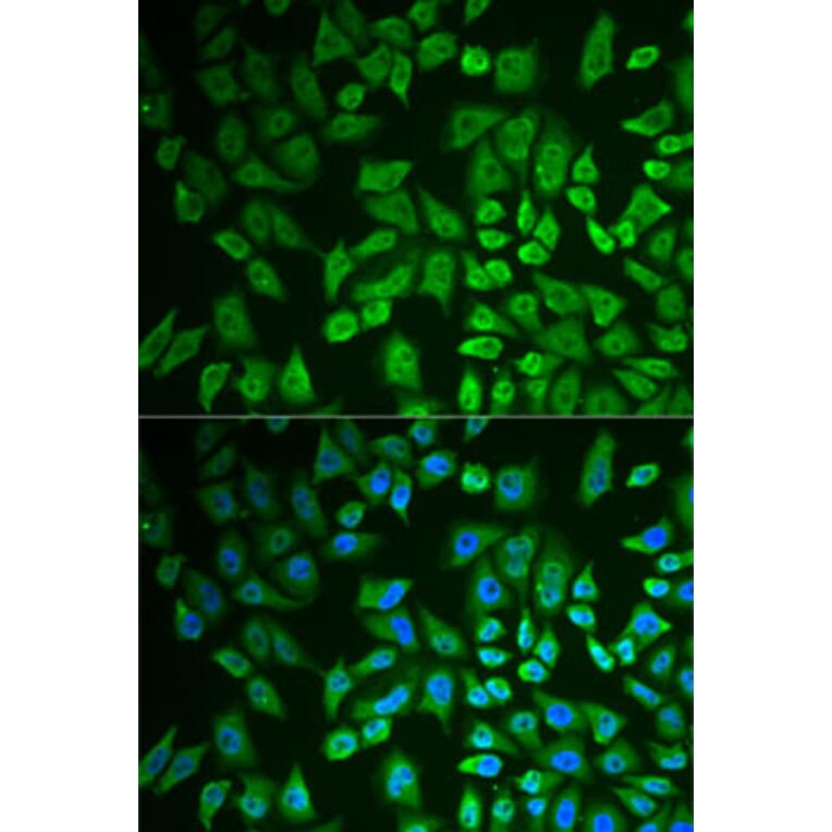 Immunofluorescence - Anti-DDX41 Antibody (A15284) - Antibodies.com