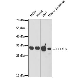 Western Blot - Anti-eEF1B2 Antibody (A15285) - Antibodies.com
