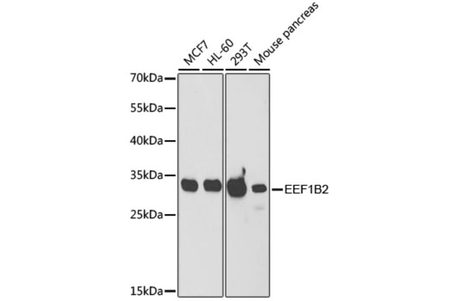 Western Blot - Anti-eEF1B2 Antibody (A15285) - Antibodies.com