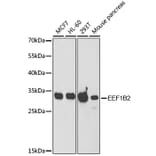 Western Blot - Anti-eEF1B2 Antibody (A15285) - Antibodies.com