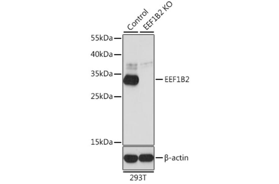 Western Blot - Anti-eEF1B2 Antibody (A15285) - Antibodies.com