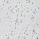 Immunohistochemistry - Anti-eEF1B2 Antibody (A15285) - Antibodies.com