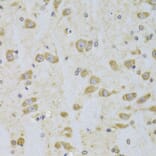 Immunohistochemistry - Anti-eEF1B2 Antibody (A15285) - Antibodies.com